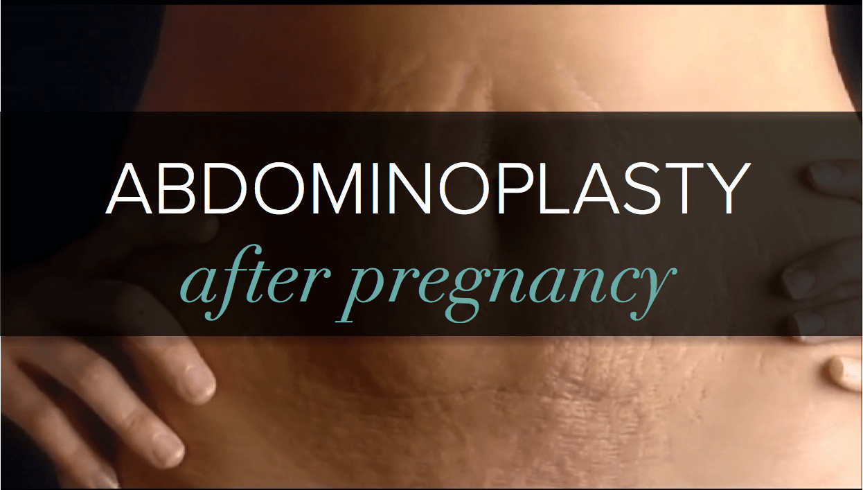 Tummy tuck after babies and birth in Brisbane