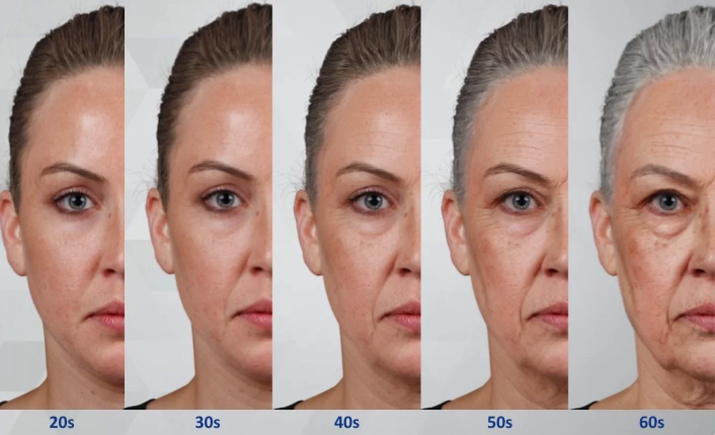 facelift surgery facial ageing